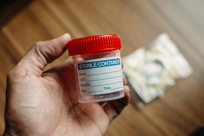 Plastic urine collector and sterile bottle for random drug test