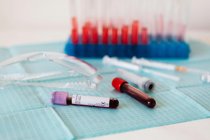 How Long Does Weed Stay In Your Blood? Does Weed Appear On A Regular Blood Test?
