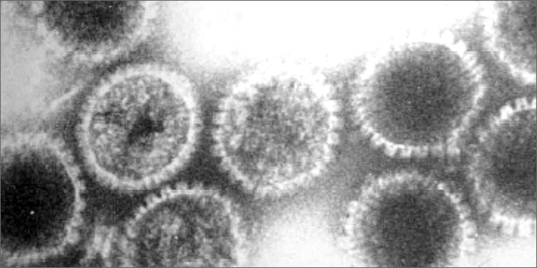 What is the herpes virus?