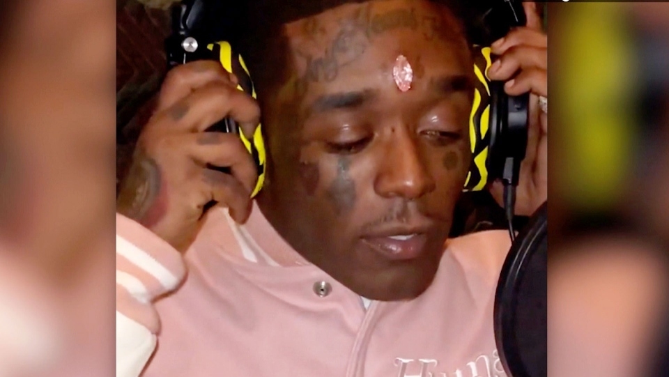 Lil Uzi Vert’s Infamous $24 Million Diamond Was Ripped Out Of His Forehead By Fans