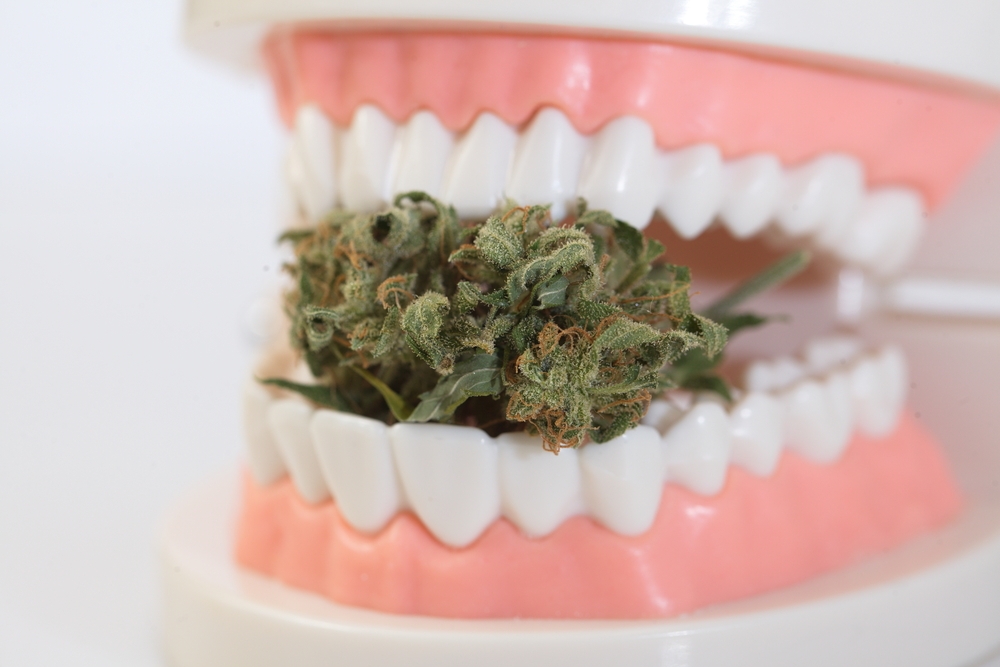 Here’s Why Stoners Should Take Extra Care Of Their Oral Health