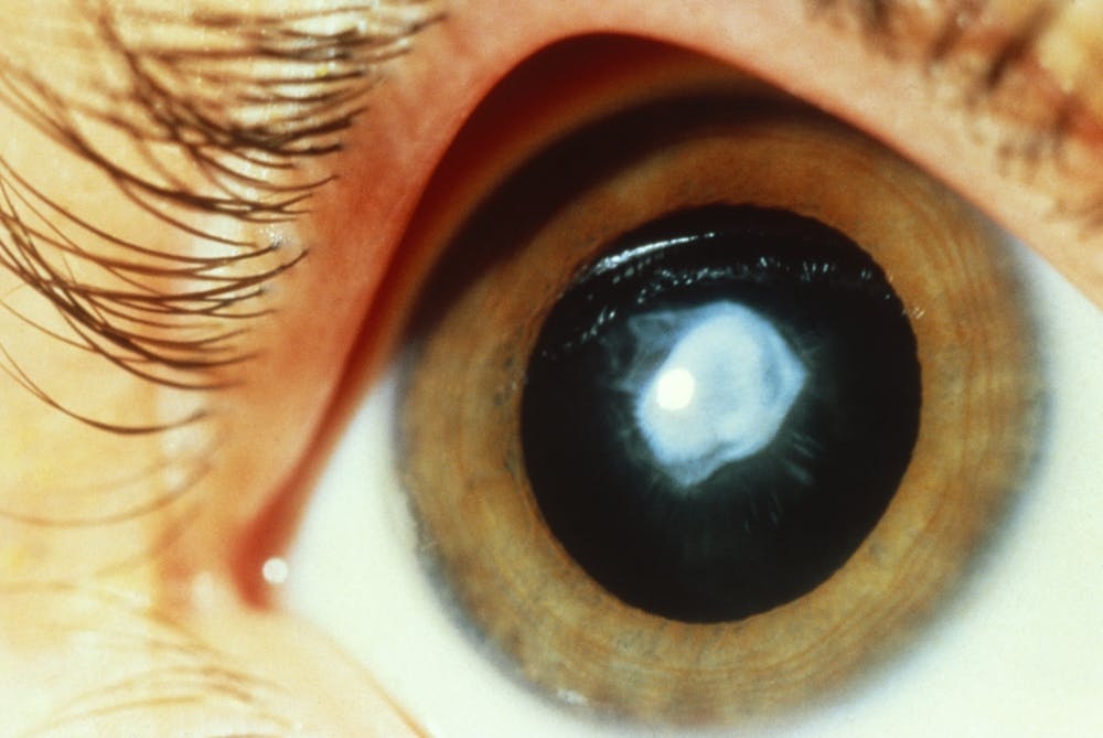 This Is What It’s Like To Be High When You’re Blind