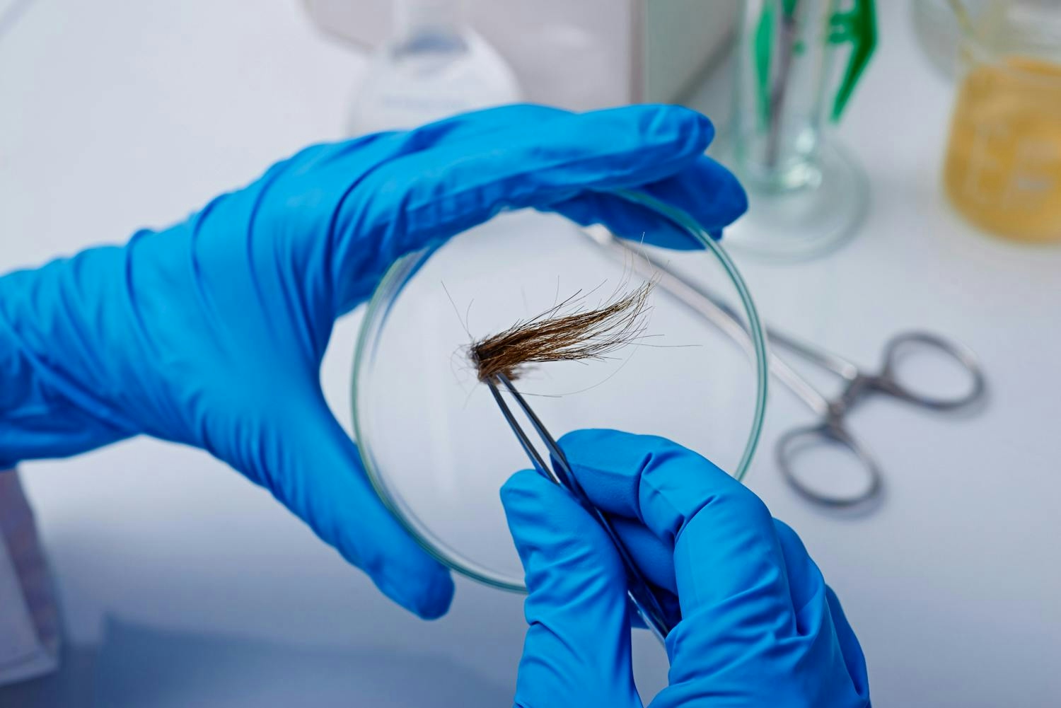 Weed Effects: How Long Does Marijuana Stay In Your System?