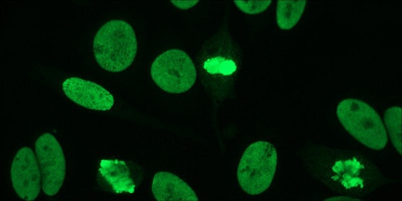 Autoimmune Diseases: How Does Cannabis Help?