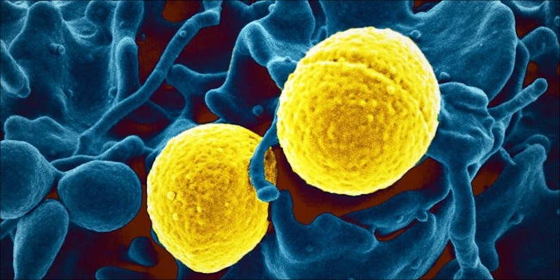 Autoimmune Diseases: How Does Cannabis Help?