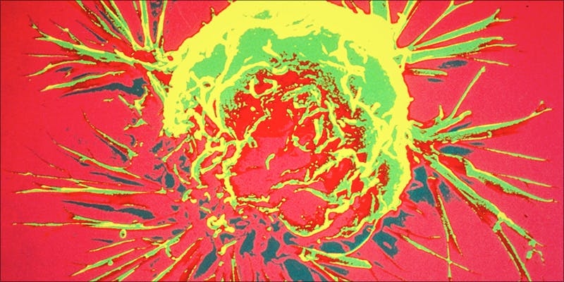 Does Cannabis Weaken Or Strengthen Your Immune System?