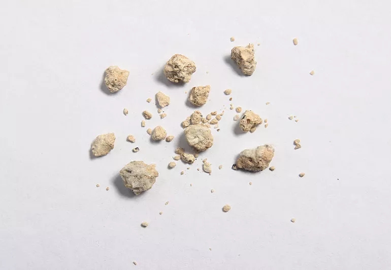 Can Weed Cause Kidney Stones? A Look Into Smoking And Kidney Stones