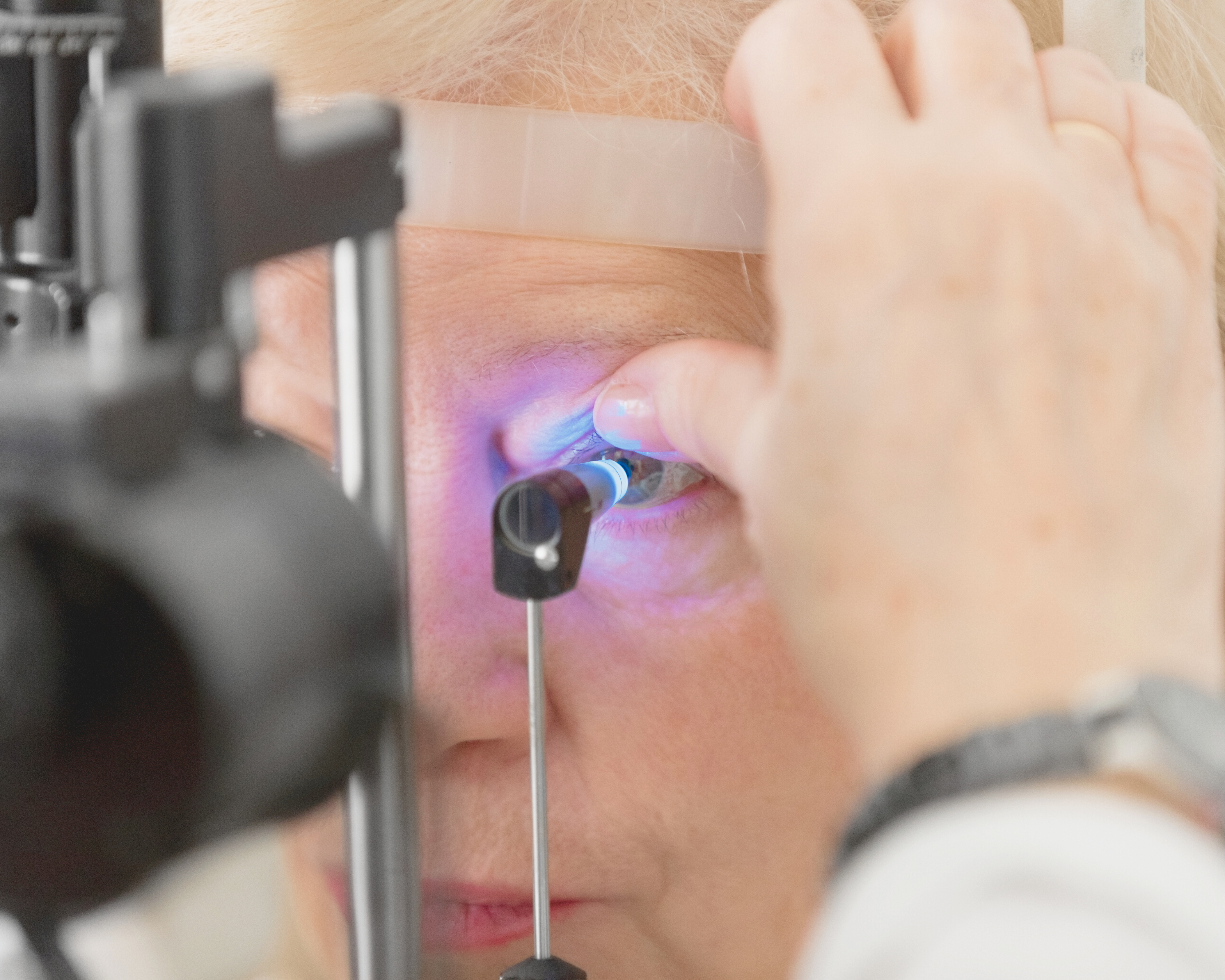 33 Cannabis Glaucoma Pressure Reduction Statistics in 2025